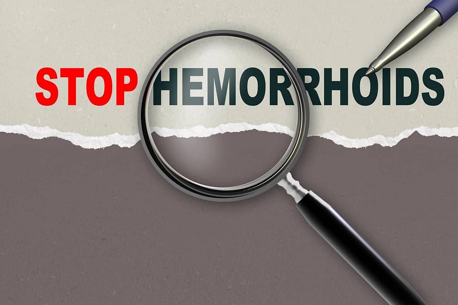 Hemorrhoid treatment natural Hemorrhoid treatment natural