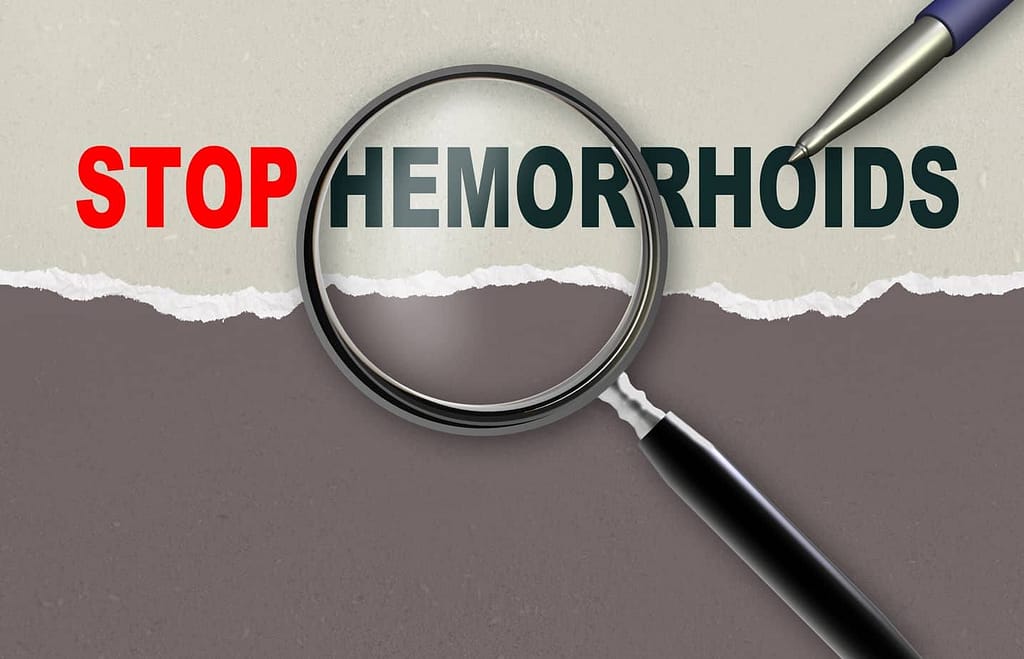 Hemorrhoid treatment natural Hemorrhoid treatment natural. How to solve an iching pain without using medication or chemicals