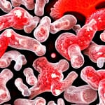 Causes of Inflammation and preventions. Anti-inflammatory diet, exercice, healthy weight, manage stress, sleep, no smoking or alcoholanti-inflammatory diet